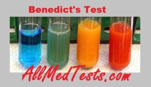 Benedict's test results