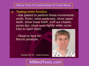 cranial nerve 7 test