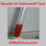 Seliwanoff’s Test result