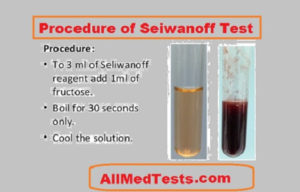 procedure of seliwanoff test