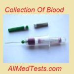 Collection of Blood: How and why is this done?