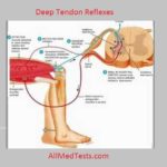 deep tendon reflexes