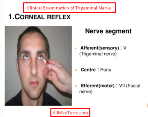 trigeminal nerve examination