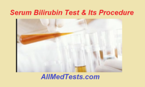 Serum Bilirubin Test