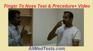 finger to nose test