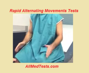 rapid alternating movement tests