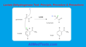 Lactate Dehydrogenase Test