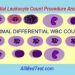 Differential Leukocyte Count Procedure And Results