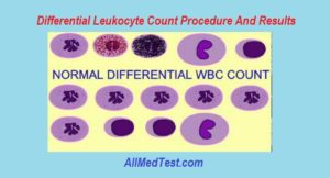Differential Leukocyte Count Procedure