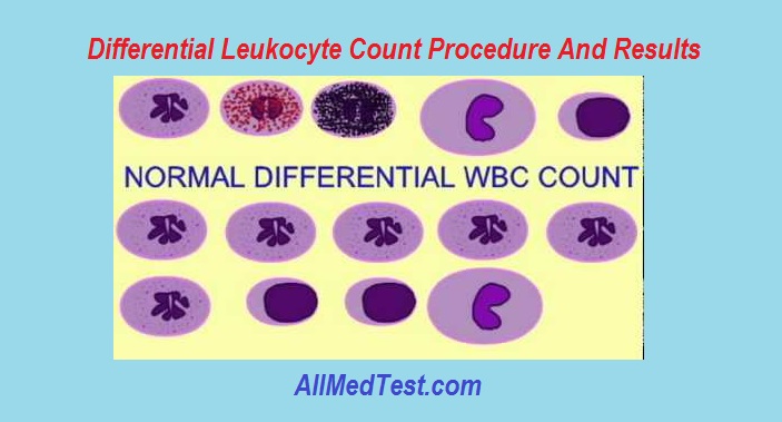 Differential Leukocyte Count Procedure And Results
